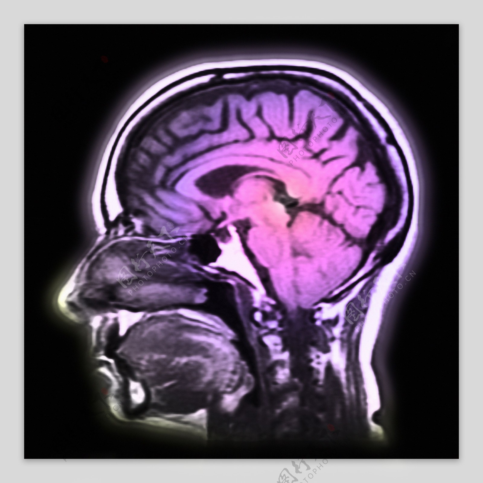 科学技术医疗大脑图层医疗图片