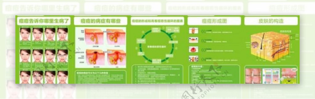 痘痘kt板图片