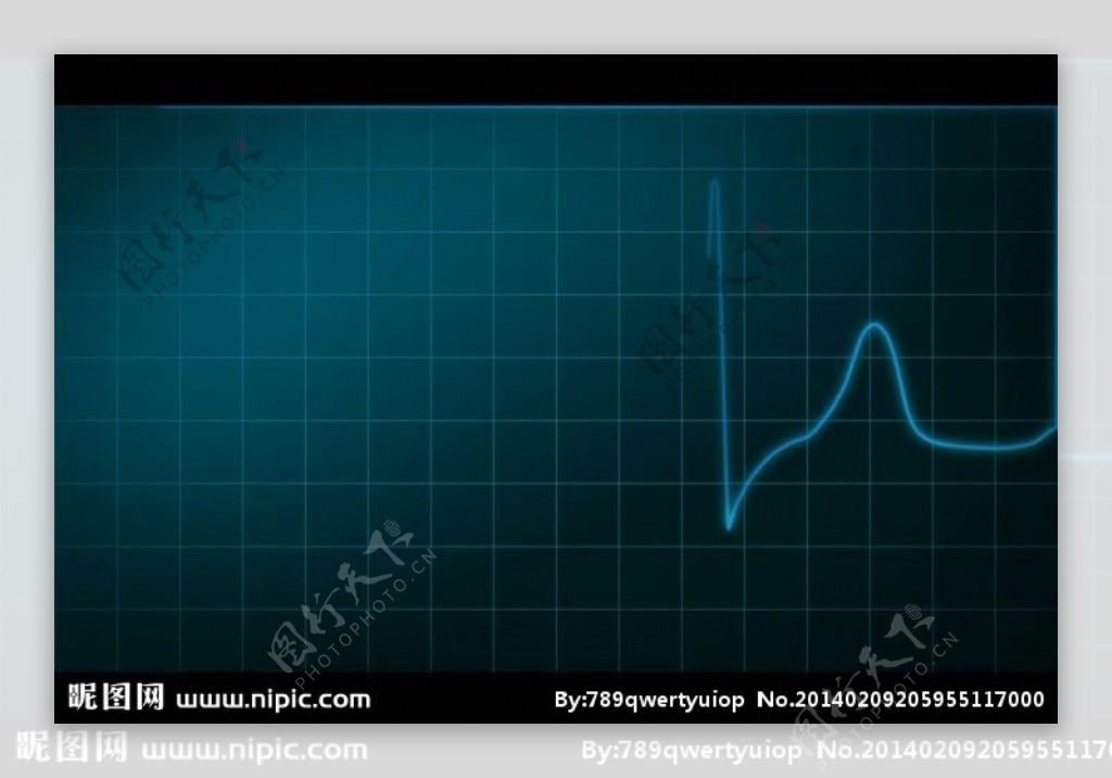 心电图视频素材