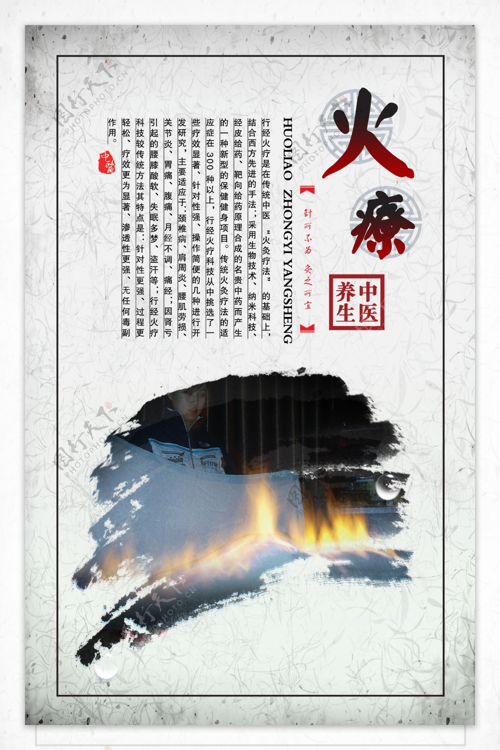 中医火疗展板海报图片