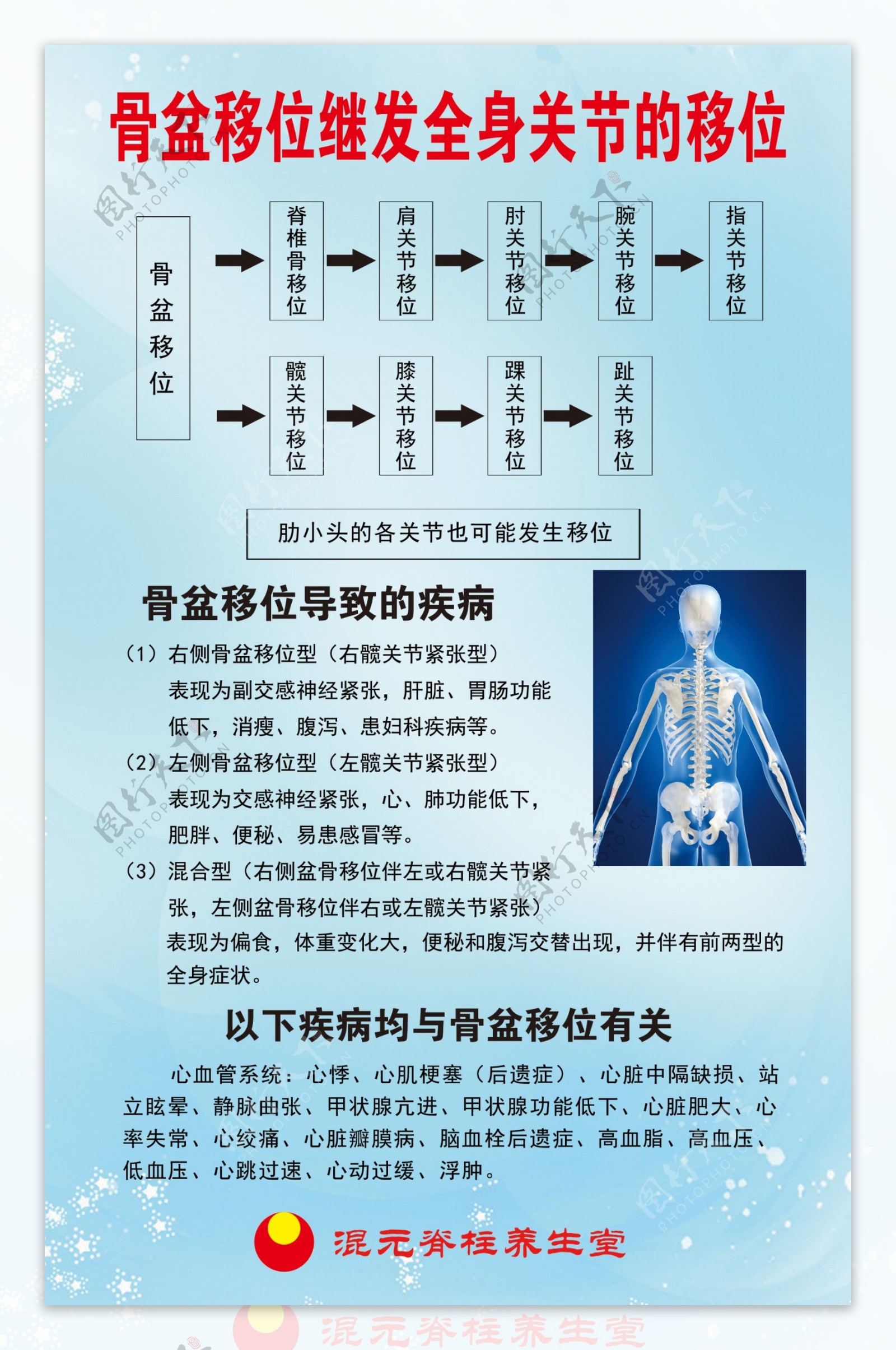 骨盆移位继发全身关节的移位展板