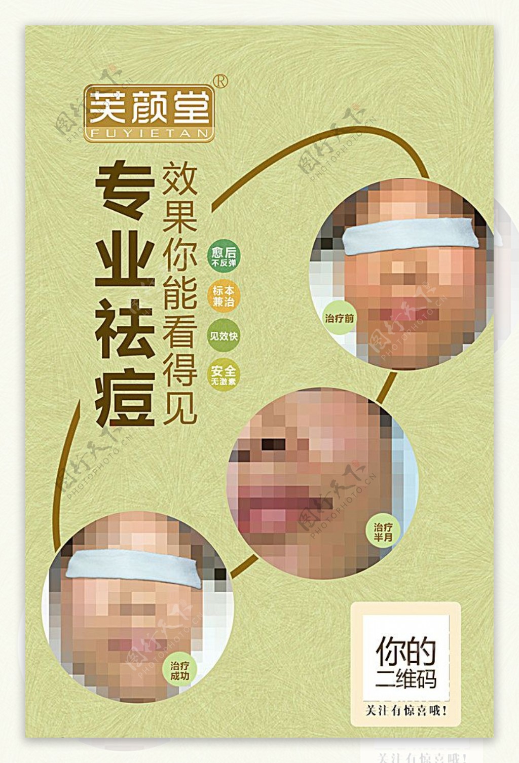 绿色医疗美容祛痘对比海报图片