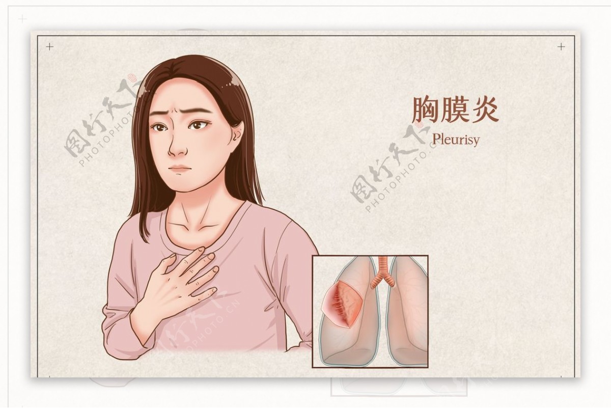 胸膜炎疾病健康卫生背景素材图片